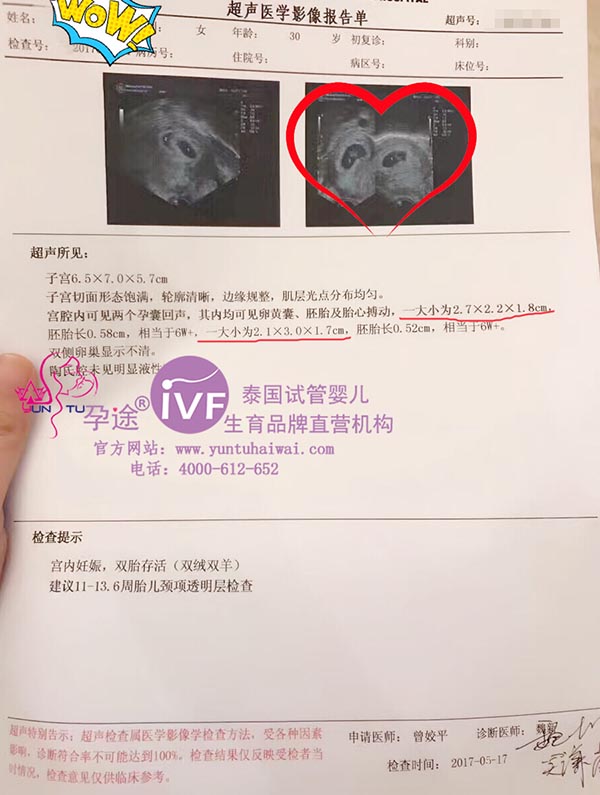 泰国试管婴儿成功