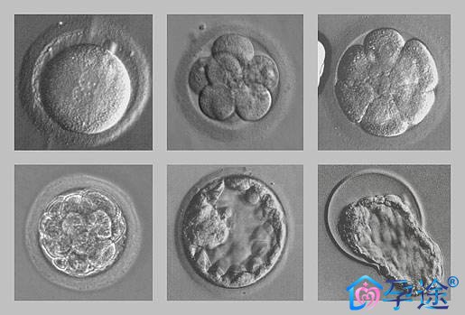 泰国试管婴儿移植后,如何保胎效果最好?